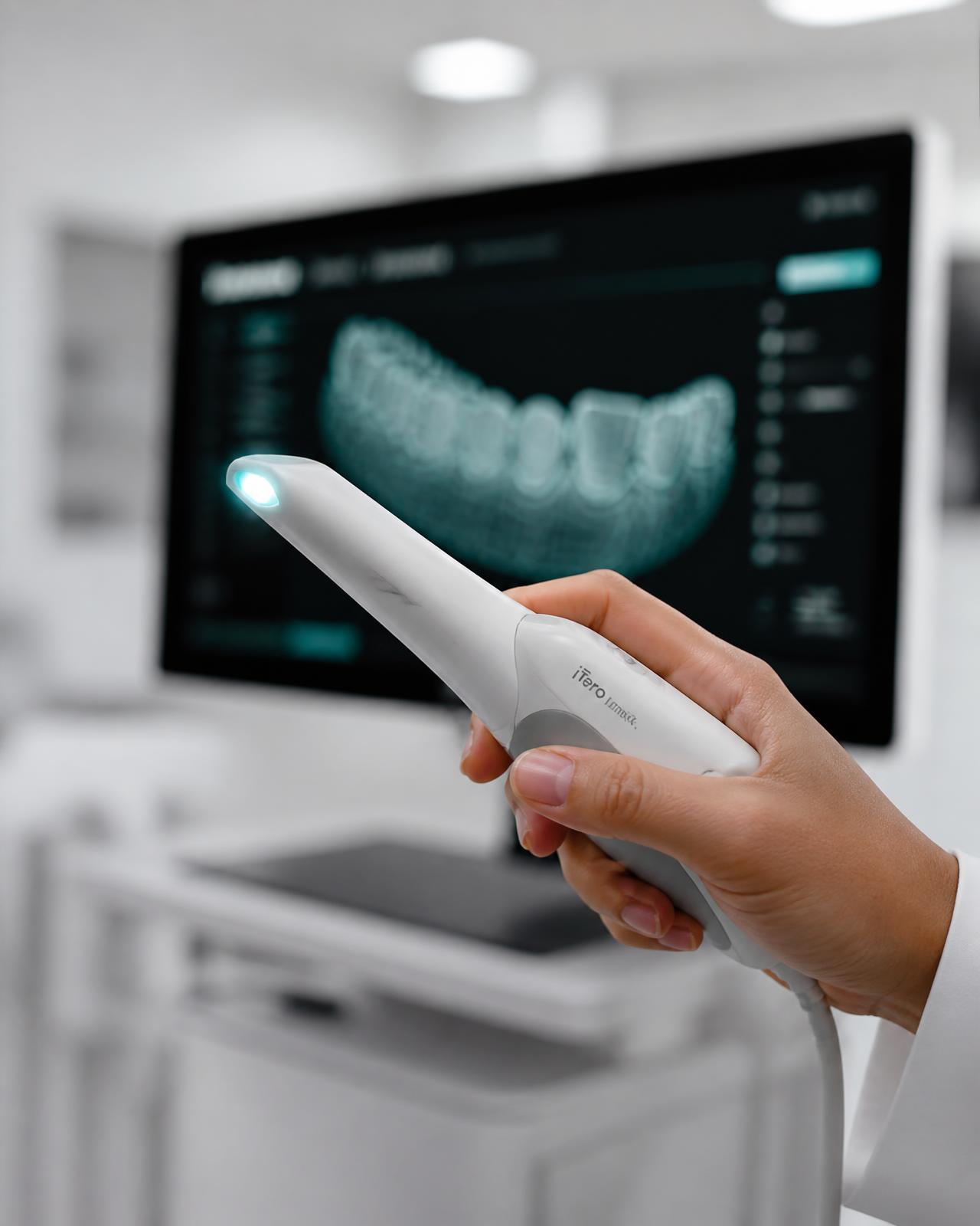 Escáner intraoral en uso frente a un monitor con el modelo dental digital